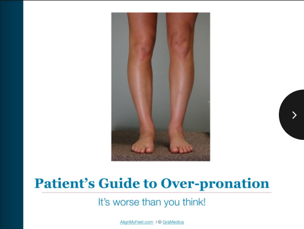 Patient’s Guide to Over-Pronation: It’s worse than you think