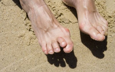 What People with Hammertoes Need to Know about Toe Implants