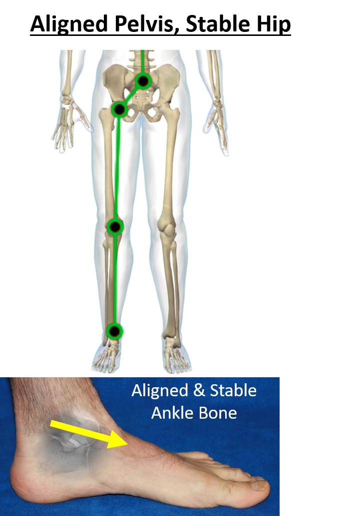 Aligned pelvis, stable hip
