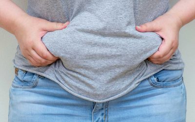 What is obesity, and what causes it?